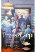 Przeszczep od mitów do rzeczywistości