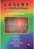 Lasery w stomatologii