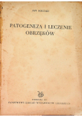 Patogeneza i leczenie obrzęków