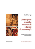 Ultrasonografia prenatalna twarzoczaszki i aberracji chromosomowych