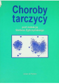 Choroby tarczycy