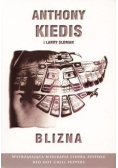 Blizna