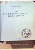 Guzy i guzopodobne zmiany kości i stawów