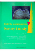 Protetyka stomatologiczna Korony i mosty