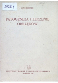 Patogeneza i leczenie obrzęków