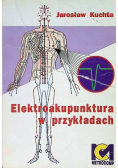 Elektroakupunktura w przykładach