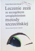 Leczenie zeza ze szczególnym uwzględnieniem metody szczecińskiej