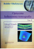 Optyczna koherentna tomografia Tom 2