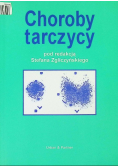 Choroby tarczycy