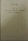 Guzy i guzopodobne zmiany kości i stawów