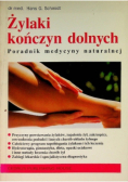 Żylaki kończyn dolnych poradnik medycyny naturalnej