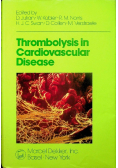 Thrombolysis in Cardiovascular Disease
