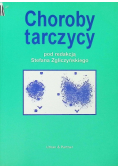 Choroby tarczycy