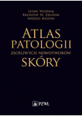 Atlas patologii złośliwych nowotworów skóry