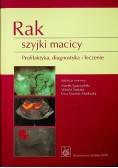 Rak szyjki macicy