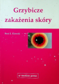 Grzybicze zakażenia skóry