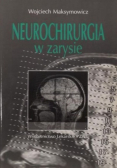 Neurochirurgia w zarysie