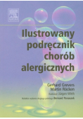 Ilustrowany podręcznik chorób alergicznych