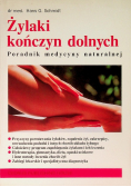Żylaki kończyn dolnych