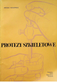 Protezy szkieletowe