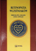 Retinopatia wcześniaków