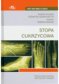 Stopa cukrzycowa