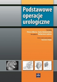 Podstawowe operacje urologiczne