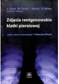 Zdjecie rentgenowskie klatki piersiowej
