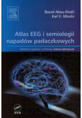 Atlas EEG i semiologii napadów padaczkowych