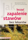 Jak leczyć zapalenie stawów bez lekarstw