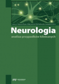 Neurologia Analiza przypadków klinicznych