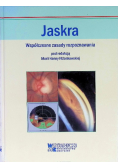 Jaskra Współczesne zasady rozpoznawania