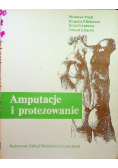 Amputacje i protezowanie