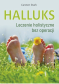 Halluks Leczenie holistyczne bez operacji