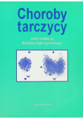 Choroby tarczycy