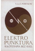 Elektropunktura Igłoterapia bez igieł