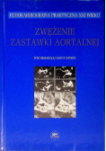 Zwężenie zastawki aortalnej