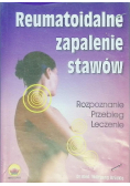 Reumatoidalne zapalenie stawów