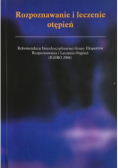Rozpoznawanie i leczenie otępień