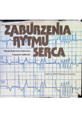 Zaburzenia rytmu serca