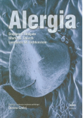 Alergia