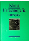 Ultrasonografia tarczycy