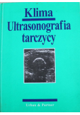Ultrasonografia tarczycy
