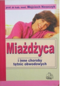 Miażdżyca i inne choroby tętnic obwodowych