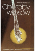 Choroby włosów