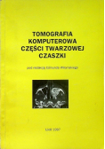 Tomografia Komputerowa Części Twarzowej Czaszki