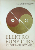 Elektropunktura. Igłoterapia bez igieł