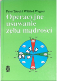 Operacyjne usuwanie zęba mądrości