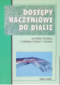 Dostępy naczyniowe do dializ