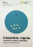 Cesarskie cięcie i poród po cięciu cesarskim
